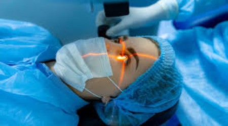 Cataract Surgery