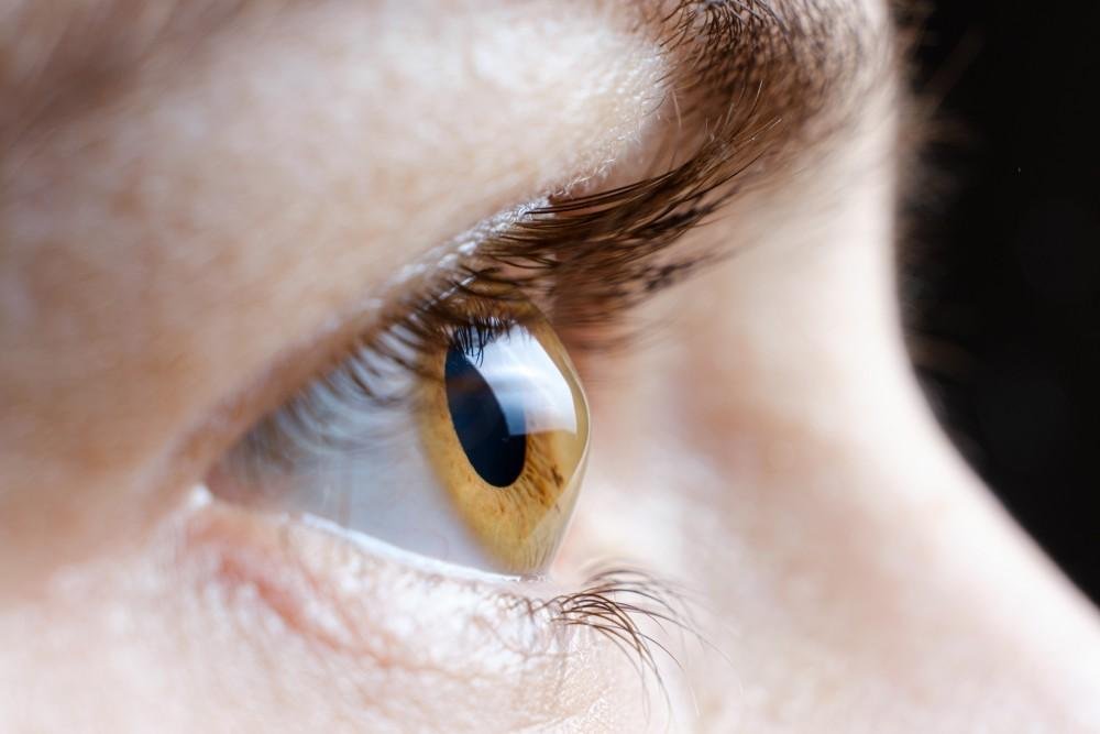 Keratoconus Treatment Jaipur